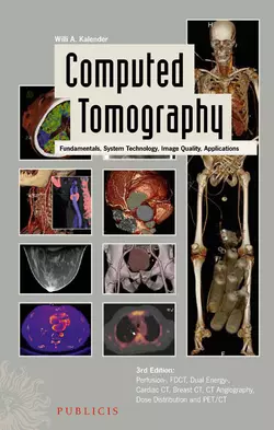 Computed Tomography. Fundamentals, System Technology, Image Quality, Applications, Willi Kalender