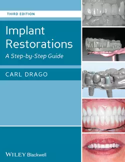 Implant Restorations. A Step-by-Step Guide, Carl Drago