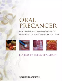 Oral Precancer. Diagnosis and Management of Potentially Malignant Disorders, Peter Thomson