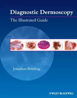 Diagnostic Dermoscopy. The Illustrated Guide, Jonathan Bowling