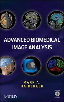 Advanced Biomedical Image Analysis, Mark Haidekker