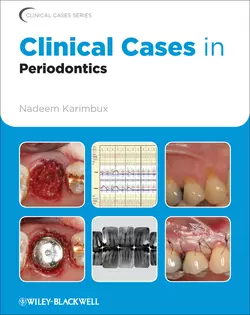 Clinical Cases in Periodontics, Nadeem Karimbux