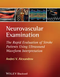 Neurovascular Examination. The Rapid Evaluation of Stroke Patients Using Ultrasound Waveform Interpretation Andrei Alexandrov