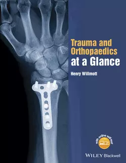 Trauma and Orthopaedics at a Glance, Henry Willmott