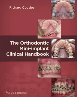 The Orthodontic Mini-implant Clinical Handbook, Richard Cousley