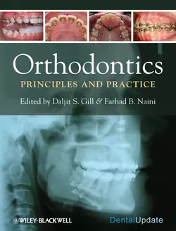 Orthodontics. Principles and Practice, Gill Daljit