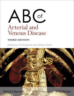 ABC of Arterial and Venous Disease, Nasim Akhtar