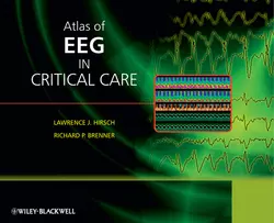 Atlas of EEG in Critical Care Brenner Richard и Hirsch Lawrence