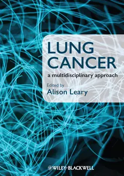 Lung Cancer. A Multidisciplinary Approach, Alison Leary