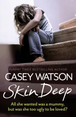 Skin Deep: All She Wanted Was a Mummy, But Was She Too Ugly to Be Loved?, Casey Watson