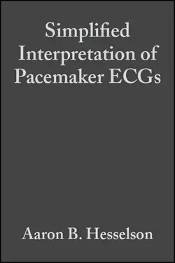 Simplified Interpretation of Pacemaker ECGs 