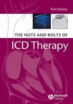 The Nuts and Bolts of ICD Therapy 