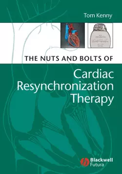 The Nuts and Bolts of Cardiac Resynchronization Therapy 