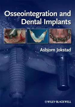 Osseointegration and Dental Implants 