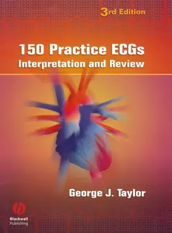 150 Practice ECGs 