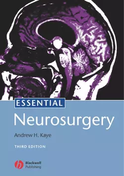 Essential Neurosurgery 