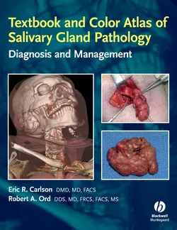 Textbook and Color Atlas of Salivary Gland Pathology, Robert Ord