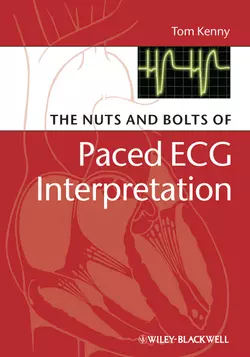 The Nuts and bolts of Paced ECG Interpretation 