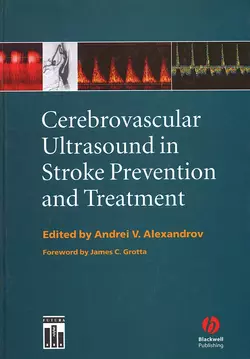 Cerebrovascular Ultrasound in Stroke Prevention and Treatment Andrei Alexandrov и James Grotta