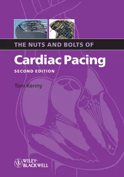 The Nuts and Bolts of Cardiac Pacing 