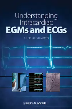 Understanding Intracardiac EGMs and ECGs 