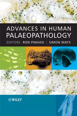 Advances in Human Palaeopathology Simon Mays и Ron Pinhasi