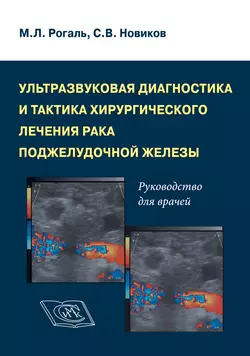 Ультразвуковая диагностика и тактика хирургического лечения рака поджелудочной железы. Руководство для врачей, Михаил Рогаль