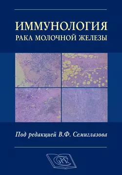 Иммунология рака молочной железы, Коллектив авторов