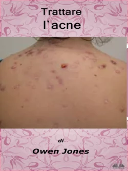 Trattare L′Acne Owen Jones