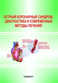 Острый коронарный синдром, диагностика и современные методы лечения, Б. Аляви