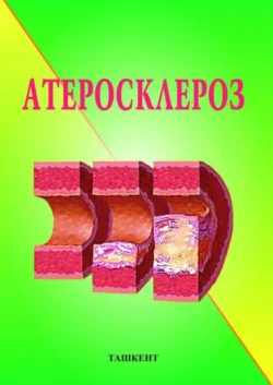 Атеросклероз Б. Аляви