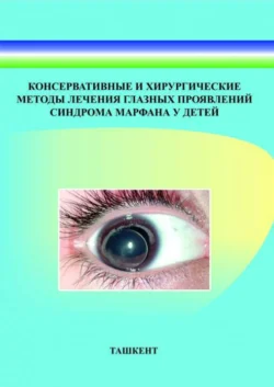 Консервативные и хирургические методы лечения глазных проявлений синдрома марфана у детей 