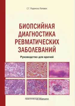 Биопсийная диагностика ревматических заболеваний. Руководство для врачей Стефка Раденска-Лоповок