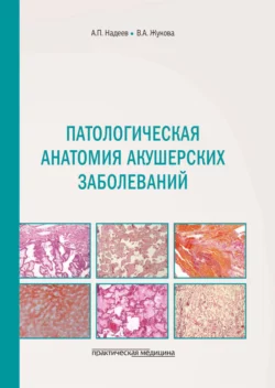 Патологическая анатомия акушерских заболеваний, Александр Надеев