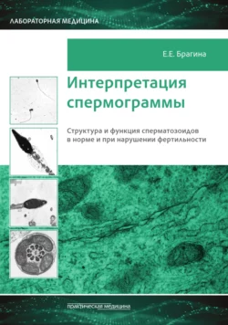 Интерпретация спермограммы. Структура и функция сперматозоидов в норме и при нарушении фертильности, Елизавета Брагина