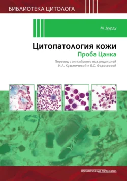 Цитопатология кожи. Проба Цанка, М. Дурду