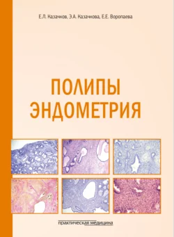 Полипы эндометрия. Учебное пособие, Евгений Казачков